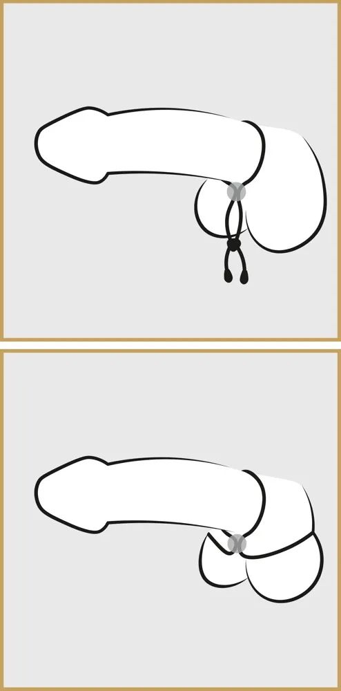 Лассо для пениса Double Cock Loop 5